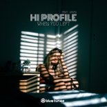 Hi Profile & Avaya - When You Left