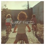 ItaloBrothers  - Bloody Knees